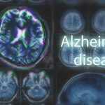 Brain scans labeled Alzheimers disease background