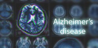 Brain scans labeled Alzheimers disease background